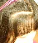 前髪・縮毛矯正　before拡大